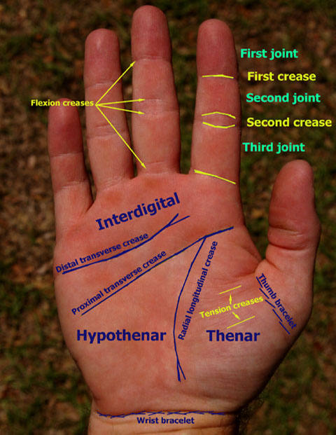 Proximal Wrist Crease